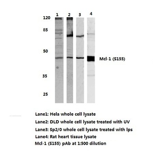 Mcl-1 (S155) pAb 