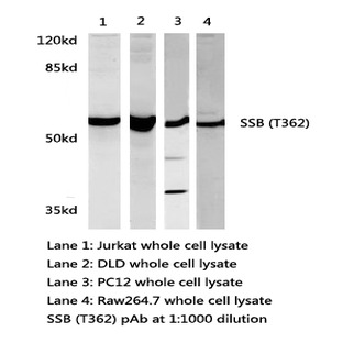 SSB(T362) pAb