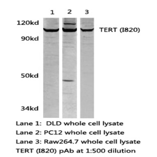TERT(I820) pAb