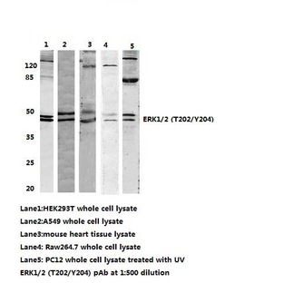 ERK1/2 (T202/Y204) pAb