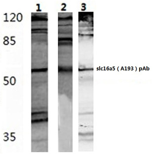 SLC16A5 (A193) pAb