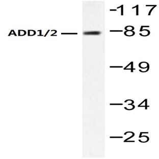 Adducin (alpha)/(beta) (K720) pAb