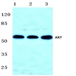 AKT (F469) pAb