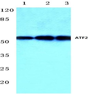 ATF2 (V63) pAb