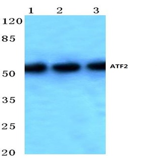 ATF2 (V65) pAb