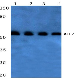 ATF2 (D67) pAb