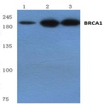 BRCA1 (Q1518) pAb