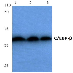 C/EBP-(beta) (S229/182) pAb