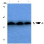 C/EBP-(beta) (S229/182) pAb