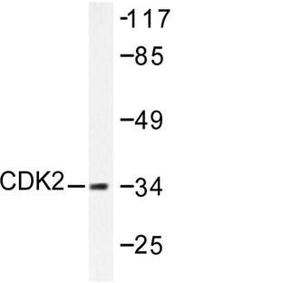 Cdk2 (V154) pAb