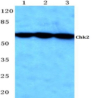 Chk2 (S62) pAb