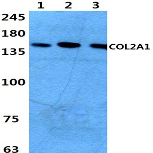 COL2A1 (P133) pAb