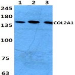 COL2A1 (P133) pAb