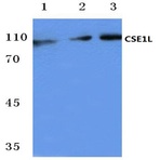 CSE1L (E2) pAb