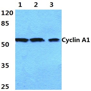 Cyclin A1 (R436) pAb