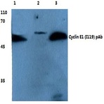 Cyclin E1 (I119) pAb