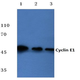 Cyclin E1 (L389) pAb