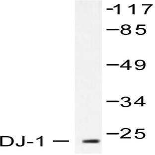 PARK7 (P54) pAb