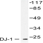 PARK7 (P54) pAb