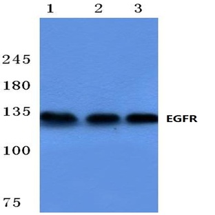 EGFR (F1086) pAb