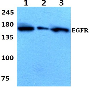 EGFR (E687) pAb