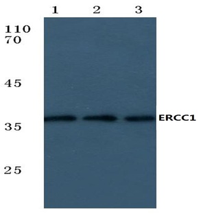 ERCC1 (V171) pAb