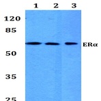 ER(alpha) (P98) pAb