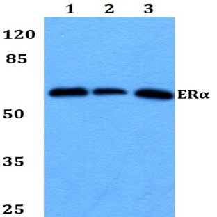 ER(alpha) (H112) pAb