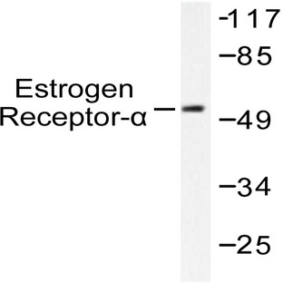 ER(alpha) (G161) pAb