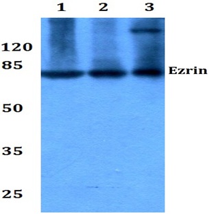 Ezrin (S539) pAb