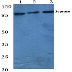 Seprase (K366) pAb