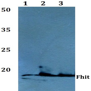 FHIT (E116) pAb