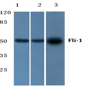 Fli-1 (R319) pAb