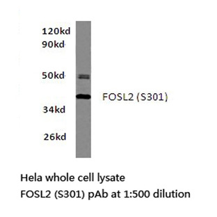 FOSL2 (S301) pAb