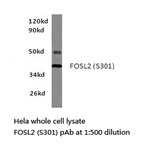 FOSL2 (S301) pAb