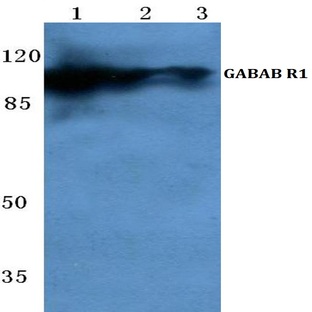 GABAB R1 (I902) pAb