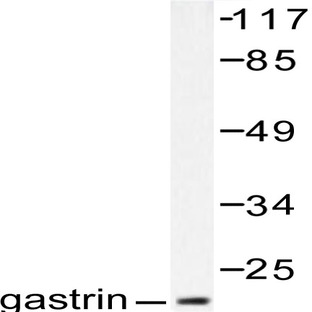 Gastrin (M90)pAb