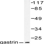 Gastrin (M90)pAb