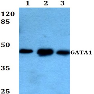 GATA1 (T304) pAb