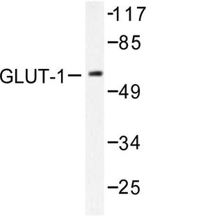 Glut 1 (G470) pAb