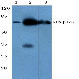 GCS-(beta)-1 (V21) pAb