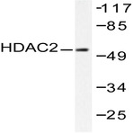 HDAC2 (D388) pAb