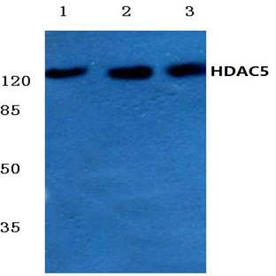 HDAC5 (E1106) pAb