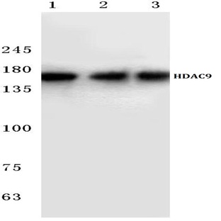 HDAC 9 (P1047) pAb