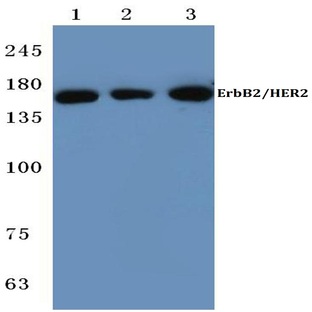 ErbB2/HER2 (P1215) pAb