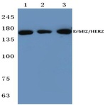 ErbB2/HER2 (P1215) pAb