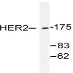 ErbB2/HER2 (T1242) pAb