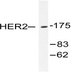 ErbB2/HER2 (D871) pAb