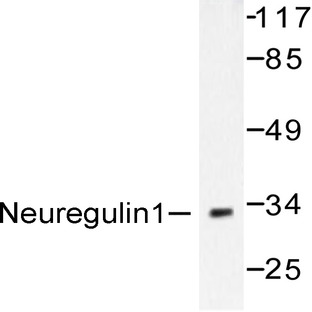 Neuregulin-1/SMDF (Y4) pAb