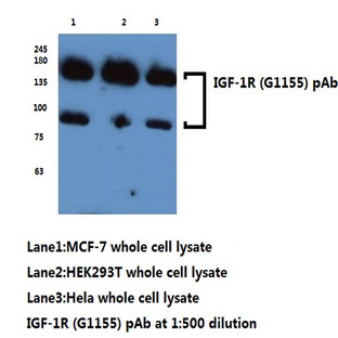 IGF-1R (G1155) pAb